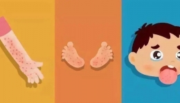 认识手足口病，不再手足无措！